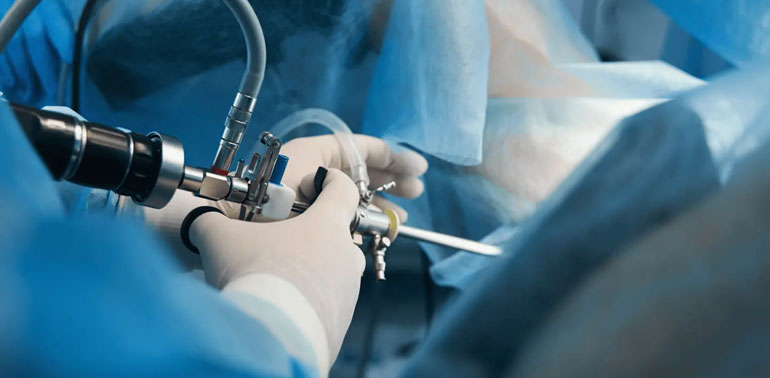 Endometrial polip əməliyyatları